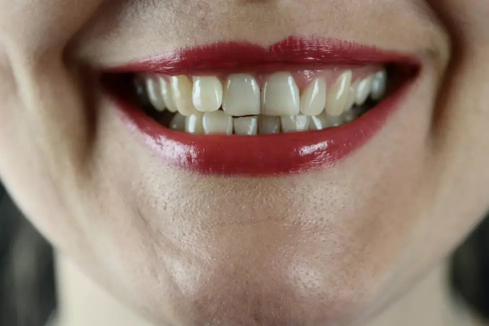 Hey New Yorkers, Let’s Talk About Weed and Your Teeth
